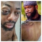 “I Was Stripped, Tortured After Rejecting N100Million Bribe” Abducted – NANS President, Isah