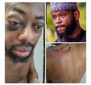 “I Was Stripped, Tortured After Rejecting N100Million Bribe” Abducted – NANS President, Isah
