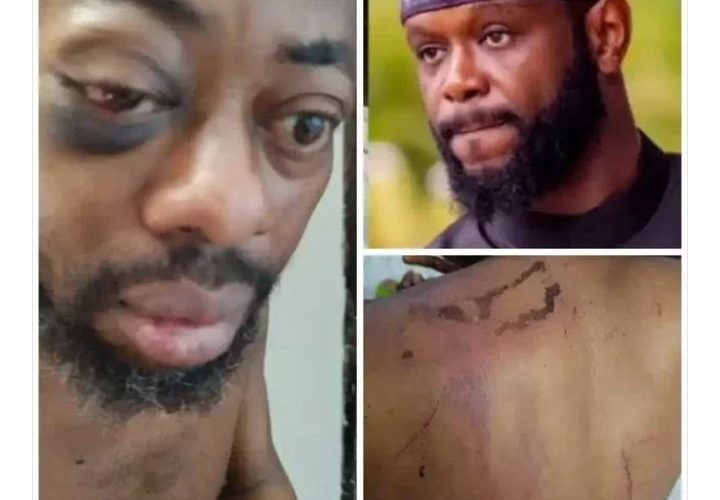 “I Was Stripped, Tortured After Rejecting N100Million Bribe” Abducted – NANS President, Isah