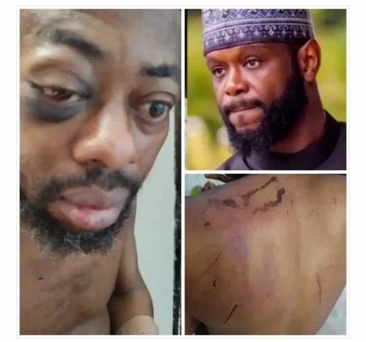 “I Was Stripped, Tortured After Rejecting N100Million Bribe” Abducted – NANS President, Isah “I Was Stripped, Tortured After Rejecting N100Million Bribe” Abducted – NANS President, Isah