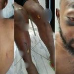 DSS Detains NANS President Atiku Isah in Hospital after Exposing Seyi’s N100Million Bribe Offer
