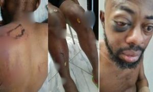 DSS Detains NANS President Atiku Isah in Hospital after Exposing Seyi’s N100Million Bribe Offer