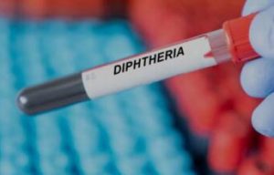 Outbreak Of Diphtheria Kills Two In Edo