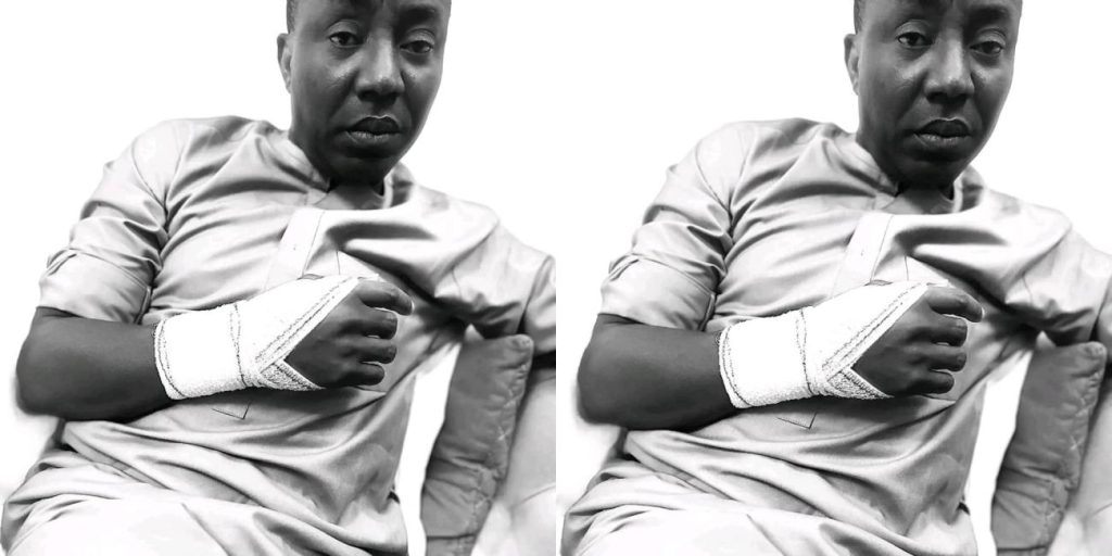 Authorities Under IGP Attempt To Cover Up Brutal Assault On Human Rights Activist, Sowore