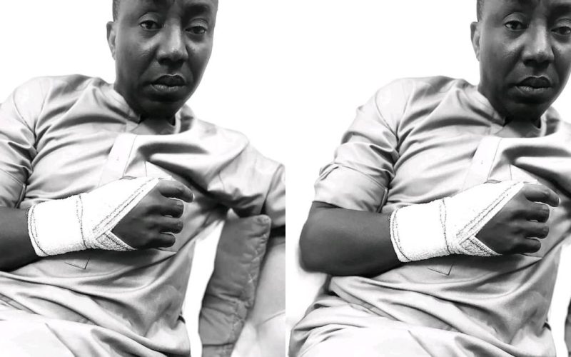 Authorities Under IGP Attempt To Cover Up Brutal Assault On Human Rights Activist, Sowore