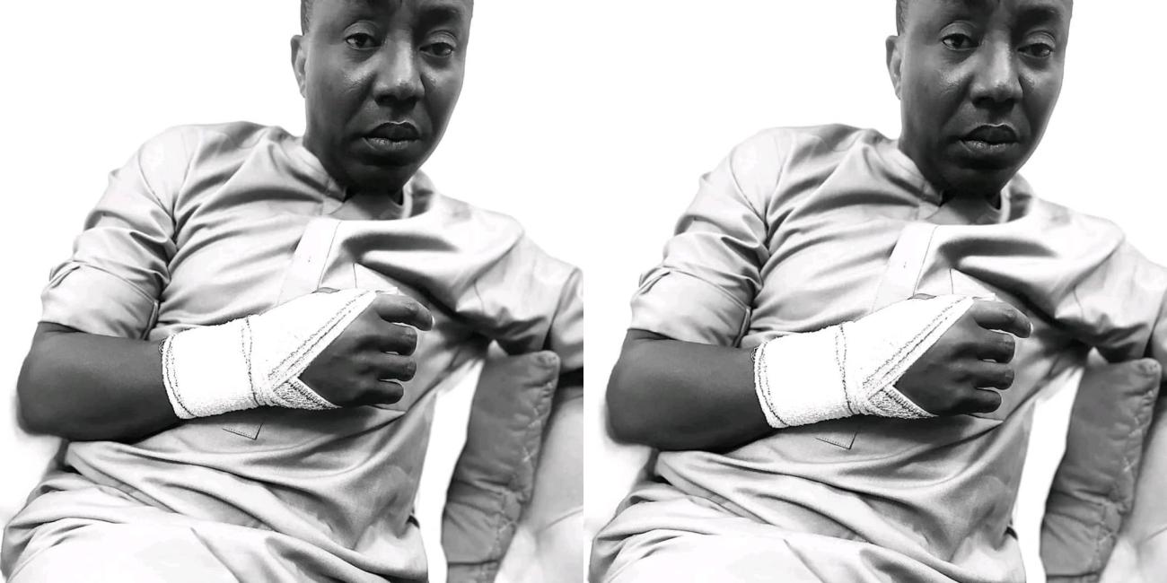Authorities Under IGP Attempt To Cover Up Brutal Assault On Human Rights Activist, Sowore