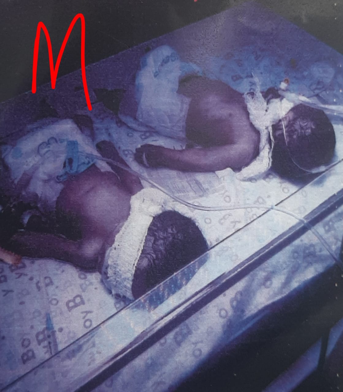 Police Reveals Cause of Death of Twin Babies in Edo