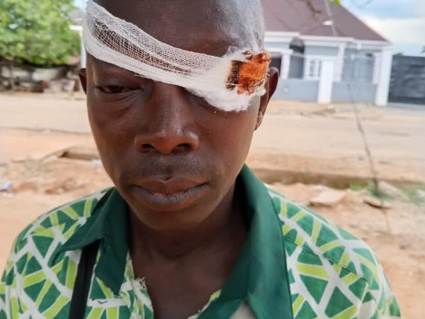APC Members In Ikole LGA Condemn Attacks on Members During Reps Primary
