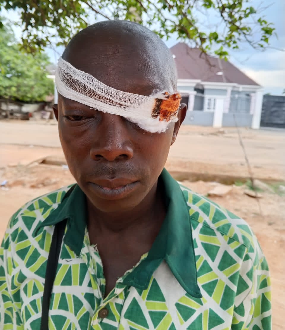 APC Members In Ikole LGA Condemn Attacks on Members During Reps Primary