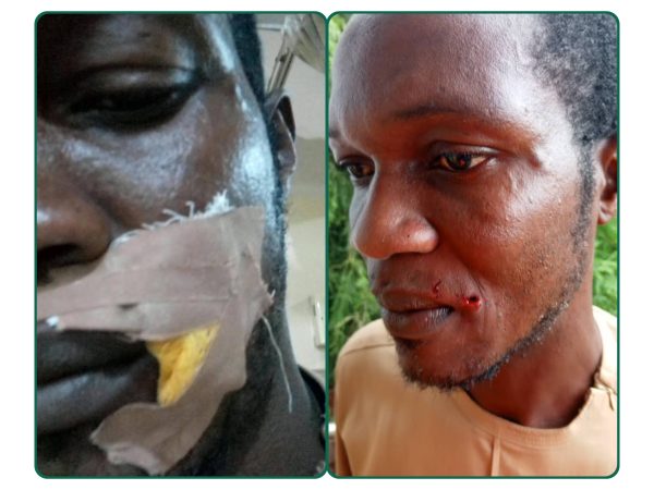 Breaking: Edo: Imansuaghon, ADC Candidate, Okonofua Escape Death In Gun Attack