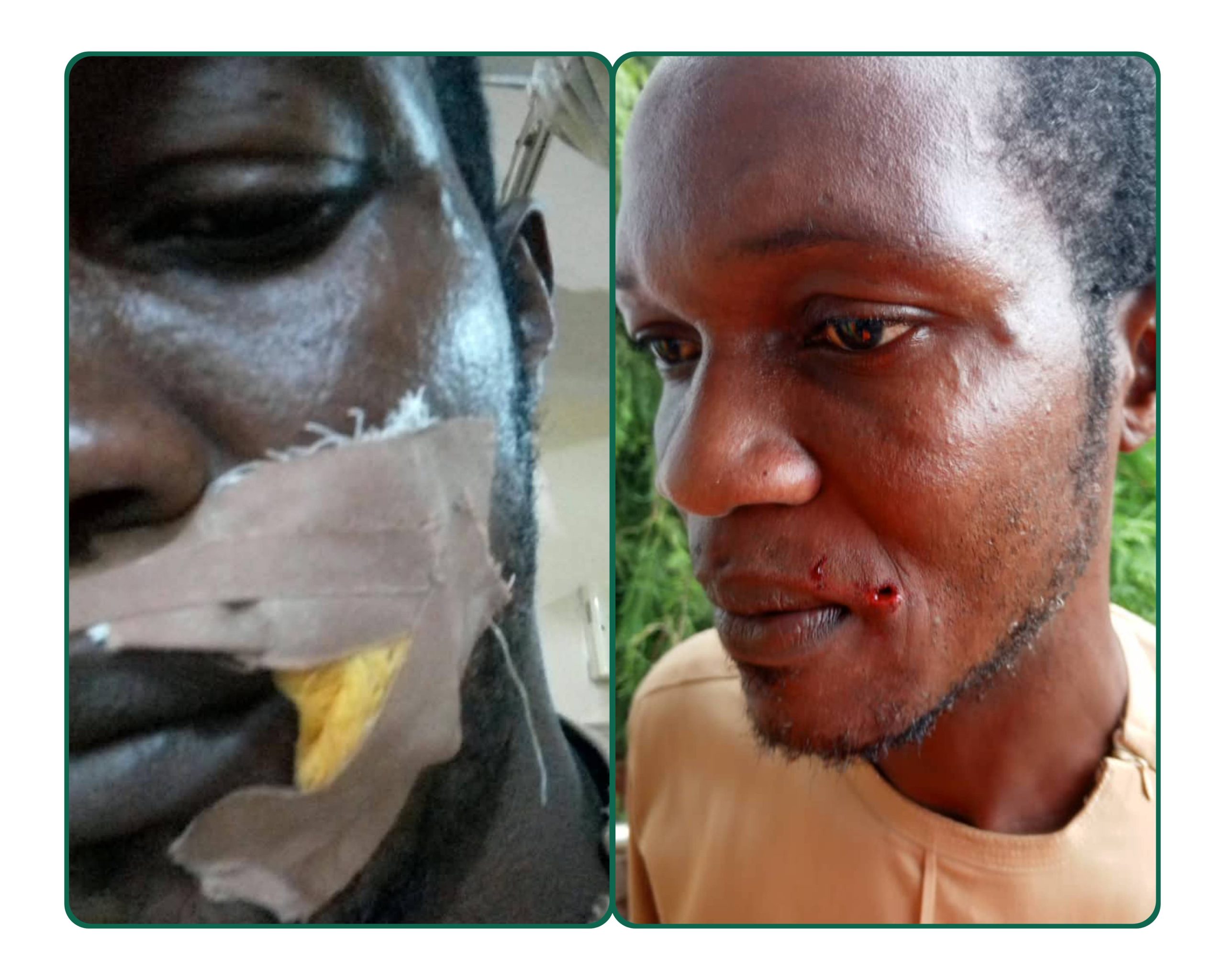 Breaking: Edo: Imansuaghon, ADC Candidate, Okonofua Escape Death In Gun Attack